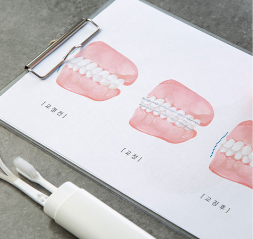 예방관리 프로그램 1